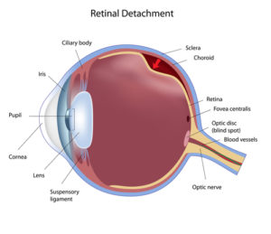 Detached Retina Veterans Benefits