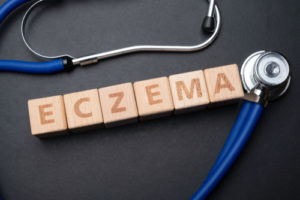 Eczema Veterans Benefits