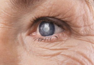 Glaucoma Veterans Benefits