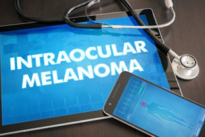 Intraocular Melanoma Veterans Benefits